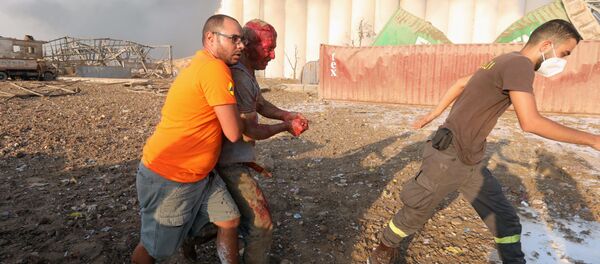 Раненые после взрыва в Бейруте (4 августа 2020). Ливан - Sputnik Армения