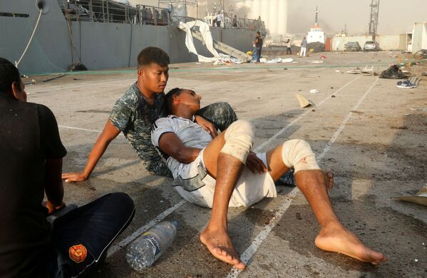 Раненые после взрыва в Бейруте (4 августа 2020). Ливан - Sputnik Արմենիա