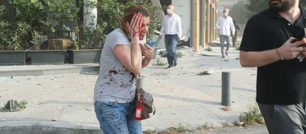 Травмированная женщина после взрыва в Бейруте (4 августа 2020). Ливан - Sputnik Արմենիա