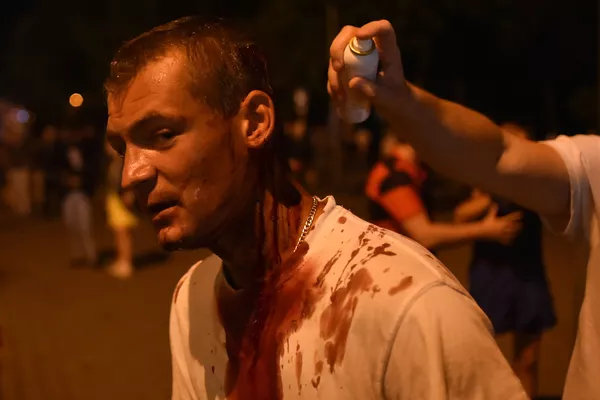 Раненый протестующий во время беспорядков в Минске после президентских выборов Раненый протестующий во время беспорядков в Минске после президентских выборов - Sputnik Армения