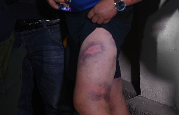 Задержанные белорусы показывают следы побоев: замглавы МВД все отрицает - Sputnik Армения