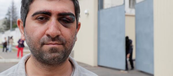 Гражданин Армении Вардан Григорян демонстрирует следы от побоев после освобождения из следственного изолятора (13 августа 2020). Минск - Sputnik Արմենիա