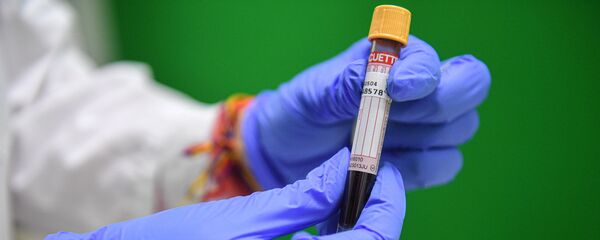 Лаборант держит в руках пробирку с пробой на антитела к COVID-19 - Sputnik Արմենիա