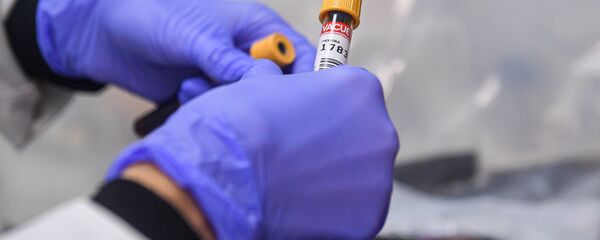 Лаборант держит в руках пробирку с пробой на антитела к COVID-19 - Sputnik Արմենիա