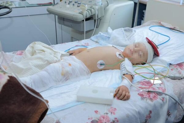 Ադրբեջանական հրետակոծությունից վիրավորված երեխա - Sputnik Արմենիա