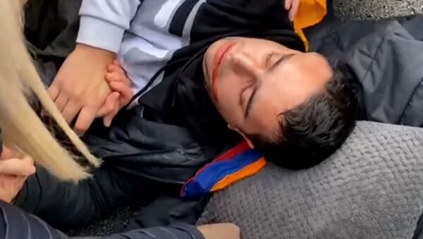 Армянмн, получивший удар молотком по голове во время акции протеста в Париже (28 октября 2020). Франция - Sputnik Армения