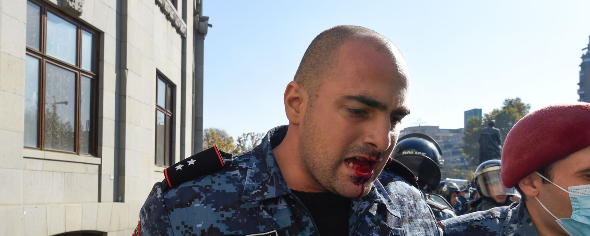 Раненный полицейский на площади Свободы (11 ноября 2020). Еревaн - Sputnik Армения, 1920, 11.11.2020