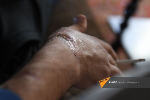 4–ամյա որդու հերոսն է. պատերազմում երկու ոտքը կորցրած Արգիշտին սոցիալական ծանր վիճակում է - Sputnik Արմենիա