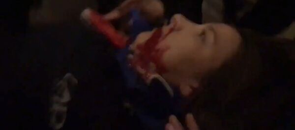 Выстрел и ранение одной из сторонниц Трампа в Вашингтоне Выстрел и ранение одной из сторонниц Трампа в Вашингтоне - Sputnik Արմենիա