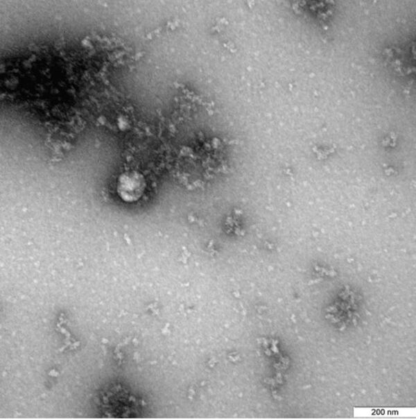 Появился первый в мире снимок британского штамма COVID-19 Появился первый в мире снимок британского штамма COVID-19 - Sputnik Армения