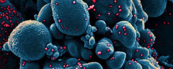 Вид на зараженную коронавирусом клетку под микроскопом Вид на зараженную коронавирусом клетку под микроскопом - Sputnik Армения