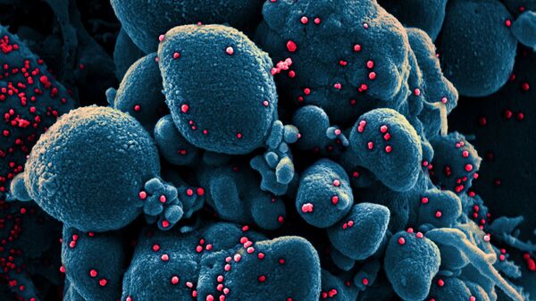Вид на зараженную коронавирусом клетку под микроскопом - Sputnik Արմենիա
