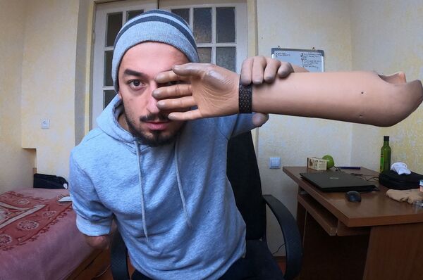 Протез здесь и сейчас... В феврале в армянском Центре для военных появится новое отделение - Sputnik Армения