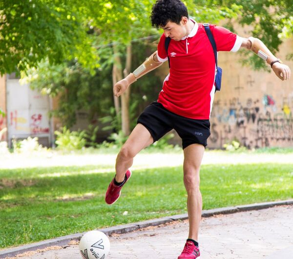 Հայրենիքի պաշտպանի վերականգնողական կենտրոնում փետրվարին պրոթեզարան կբացվի - Sputnik Արմենիա