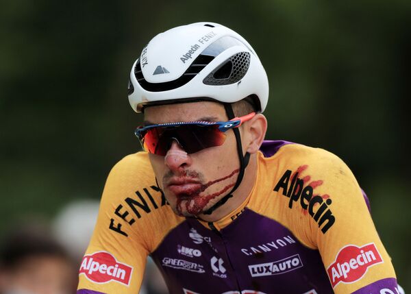 Итальянский велогонщик ​​Кристиан Сбарагли после аварии - Sputnik Армения