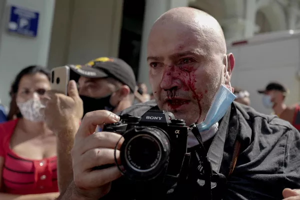 Фотограф AP, испанец Рамон Эспиноса, с травмами на лице освещает демонстрацию против президента Кубы Мигеля Диас-Канеля в Гаване Фотограф AP, испанец Рамон Эспиноса, с травмами на лице освещает демонстрацию против президента Кубы Мигеля Диас-Канеля в Гаване - Sputnik Армения
