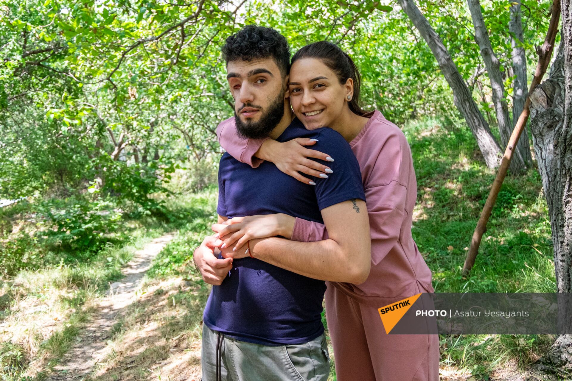 Получивший травму лица во время карабахской войны Вреж Бадалян с женой Кристиной - Sputnik Армения, 1920, 14.09.2021