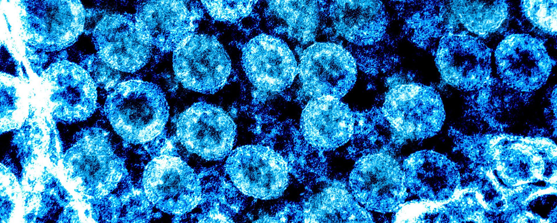 Микрофотография с улучшением цвета просвечивающего электрона вирусных частиц SARS-CoV-2, выделенных у пациента - Sputnik Արմենիա, 1920, 04.01.2022