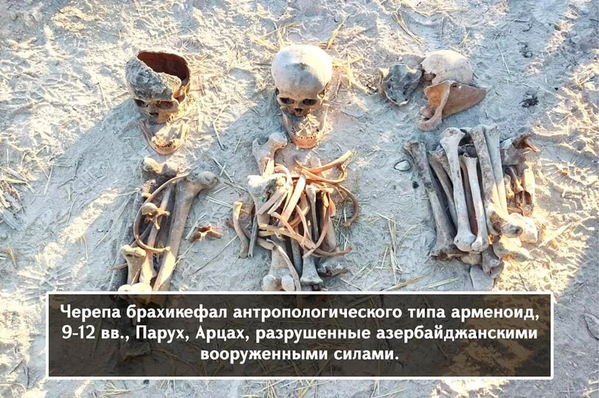 Черепа брахикефал антропологического типа арменоид, 9-12 века, Парух, Арцах, разрушенные азербайджанскими ВС Черепа брахикефал антропологического типа арменоид, 9-12 века, Парух, Арцах, разрушенные азербайджанскими ВС - Sputnik Армения, 1920, 02.04.2022