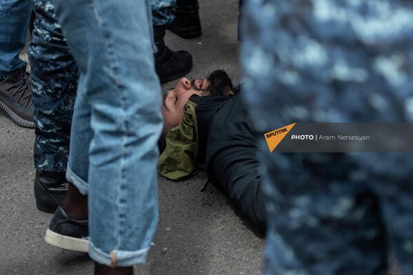 Пострадавший после стычки с полицией участник шествия оппозиции в рамках акции неповиновения (10 мая 2022). Еревaн - Sputnik Армения