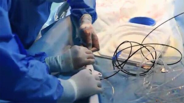 Վիրահատություն. արխիվային լուսանկար - Sputnik Արմենիա