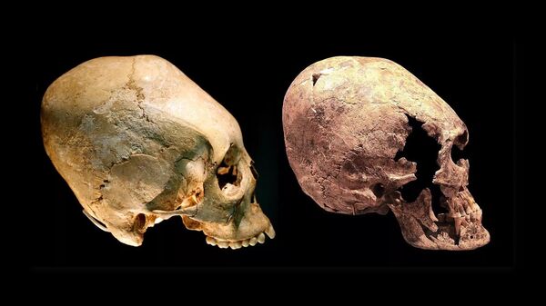 Вытянутый череп молодой женщины из Национального музея Вюртемберга, начало VI века, алеманнская культура - Sputnik Армения