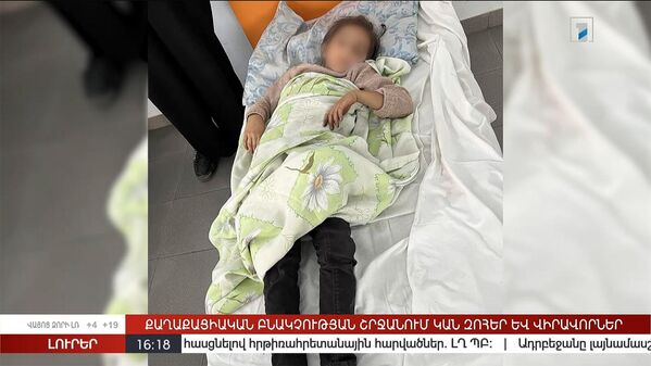 Общественное телевидение Армении опубликовало фотографии получивших ранения детей в Нагорном Карабахе  - Sputnik Армения