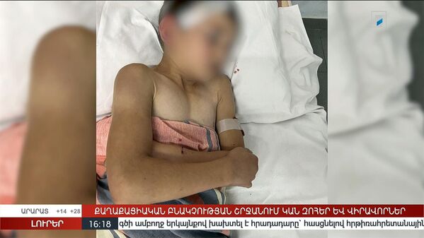 Общественное телевидение Армении опубликовало фотографии получивших ранения детей в Нагорном Карабахе  - Sputnik Армения