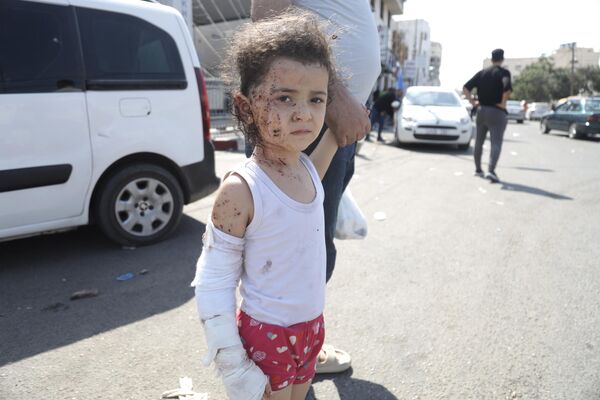 Ребенок, пострадавший в результате ракетных ударов ВС Израиля по Газе - Sputnik Армения