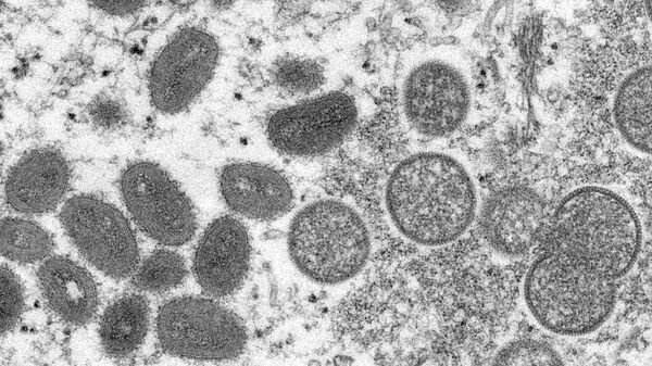Вирус обезьяньей оспы на разных этапах инкубационного периода под микроскопом  - Sputnik Армения