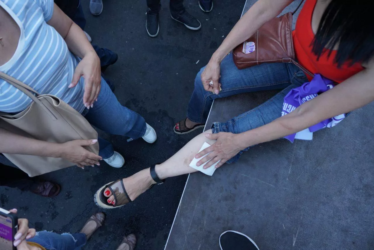 İrəvandakı aksiyada saxlanılanların və xəsarət alanların sayı açıqlandı - FOTO / YENİLƏNİB