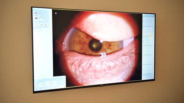 Почему в Армении до сих пор не пересаживают роговицы глаз от местных доноров - Sputnik Армения