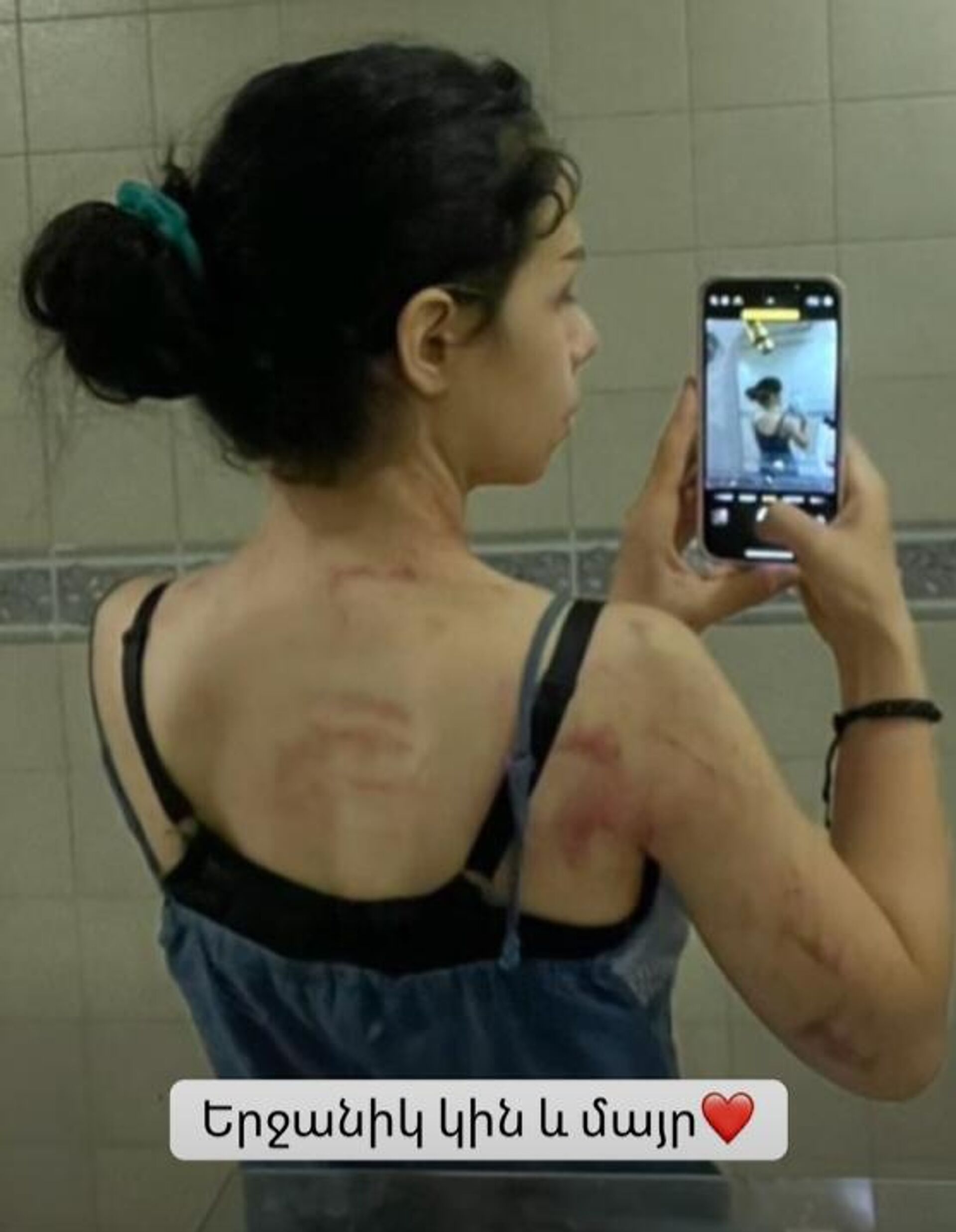 Актриса Мари Петросян опубликовала фотографии насилия - Sputnik Արմենիա, 1920, 25.11.2025