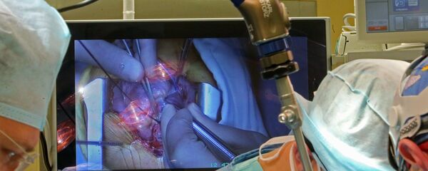 Операция на открытом сердце в Калининградском Центре сердечно-сосудистой хирургии Операция на открытом сердце в Калининградском Центре сердечно-сосудистой хирургии - Sputnik Արմենիա