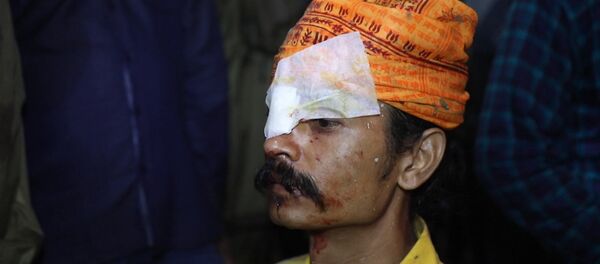 В Индии люди обращались в больницу после фестиваля метания камней В Индии люди обращались в больницу после фестиваля метания камней - Sputnik Армения