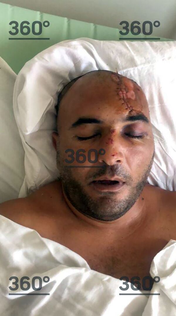 Гражданин Армении, который неудачно спрыгнул с крыши мимо бассейна - Sputnik Армения