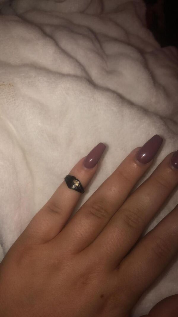 Пропало 12 лет назад: синеволосая британка чихнула и нашла в носу нечто невероятное - Sputnik Армения