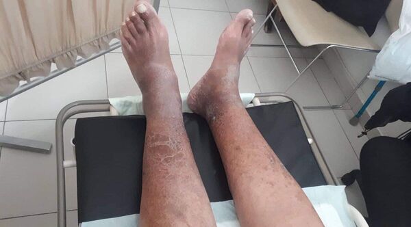 Амнистированный может умереть в тюрьме: власти Армении не отпускают его на свободу Амнистированный может умереть в тюрьме: власти Армении не отпускают его на свободу - Sputnik Армения