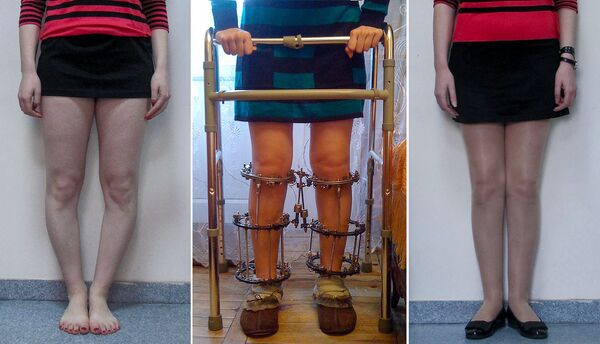 Едут в Армению, чтобы вырасти, или Как армянский ортопед осчастливил японца - Sputnik Армения