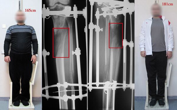 Едут в Армению, чтобы вырасти, или Как армянский ортопед осчастливил японца - Sputnik Армения