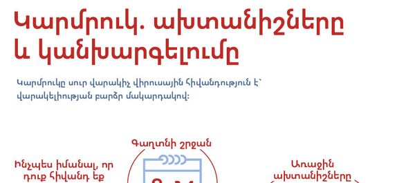 Կարմրուկ. ախտանիշները և կանխարգելումը - Sputnik Արմենիա