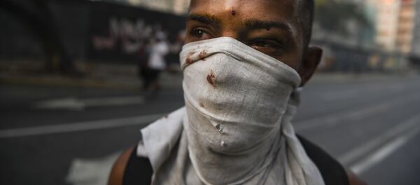 Протестующий, раненный в столкновениях с Национальной гвардией Венесуэлы в Альтамире, районе Каракаса - Sputnik Армения