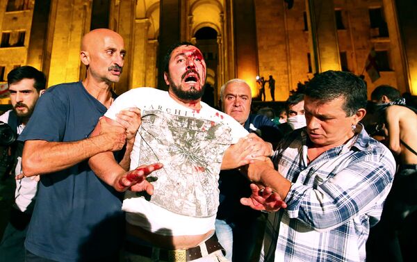 Демонстранты помогают раненому во время акции протеста против визита российского депутата Грузию (21 июня 2019). Тбилиси - Sputnik Армения