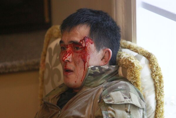 Киргизский полицейский, пострадавший во время спецоперации по задержанию бывшего президента Киргизии Алмазбека Атамбаева - Sputnik Армения