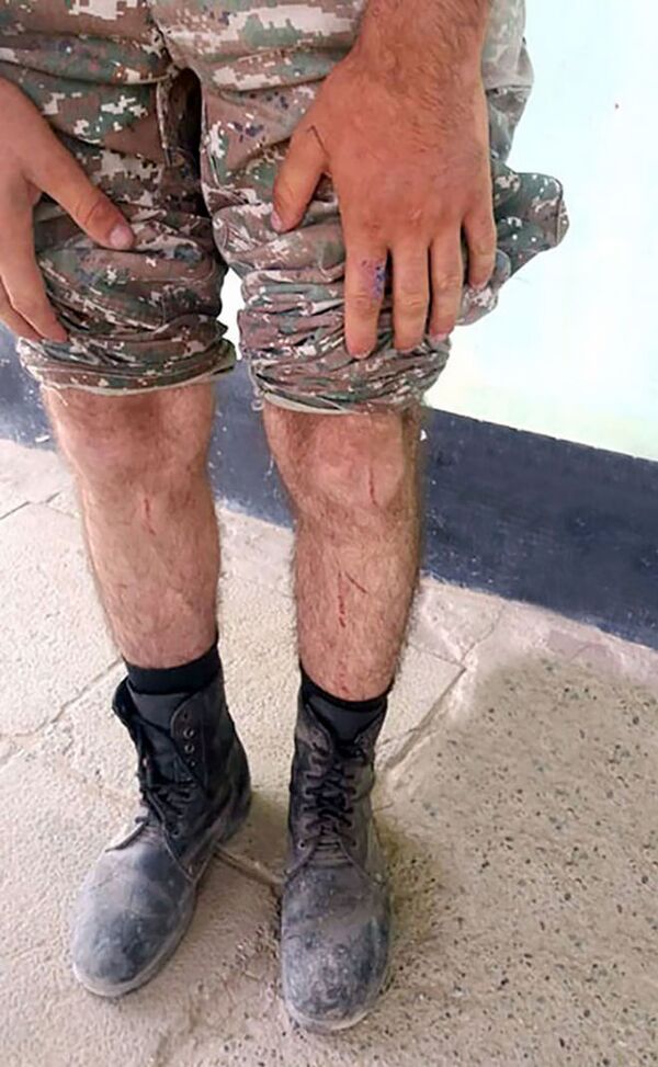 Ինչ վնասվածք է Ադրբեջանում հայտնված զինվորի ձեռքի վրա. նոր մանրամասներ Ինչ վնասվածք է Ադրբեջանում հայտնված զինվորի ձեռքի վրա. նոր մանրամասներ - Sputnik Արմենիա