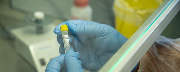 Тест по выявлению коронавируса в Национальном центре по контролю и профилактике заболеваний Тест по выявлению коронавируса в Национальном центре по контролю и профилактике заболеваний - Sputnik Армения