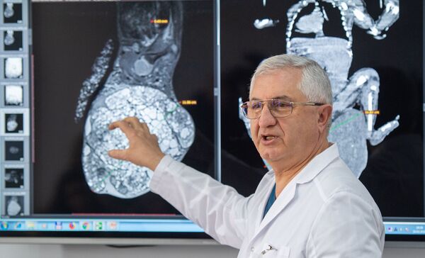 Հայ հրաշագործ բժիշկները, կամ ահռելի գոյացությամբ ծնված երեխայի բախտը բերել է - Sputnik Արմենիա