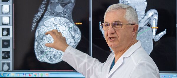 Директор МЦ Сурб Аствацамайр Николай Даллакян представляет подробности успешно прошедшей редчайшей операции (10 февраля 2020). Еревaн - Sputnik Армения