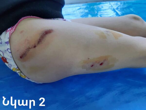 Երևանում դպրոցի ճանապարհին 22 երեխայի են կծել. որ դեպքում են ագրեսիվանում ստերջացված շները - Sputnik Արմենիա