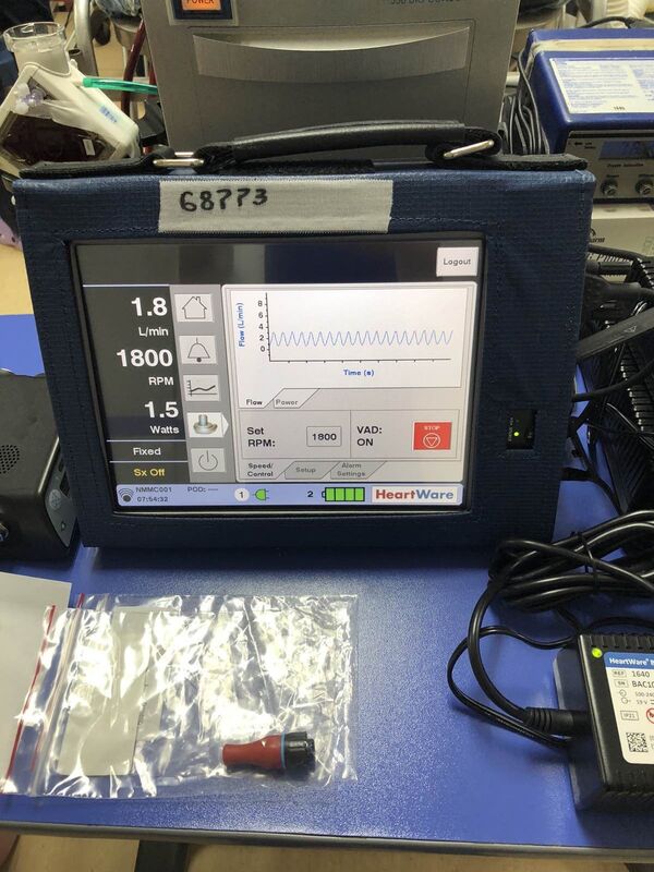 Հայաստանում կատարված սրտի բացառիկ վիրահատությունը` լուսանկարներով Հայաստանում կատարված սրտի բացառիկ վիրահատությունը` լուսանկարներով - Sputnik Արմենիա